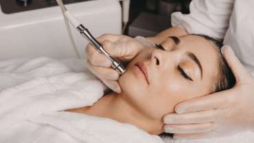 Microdermabrasion